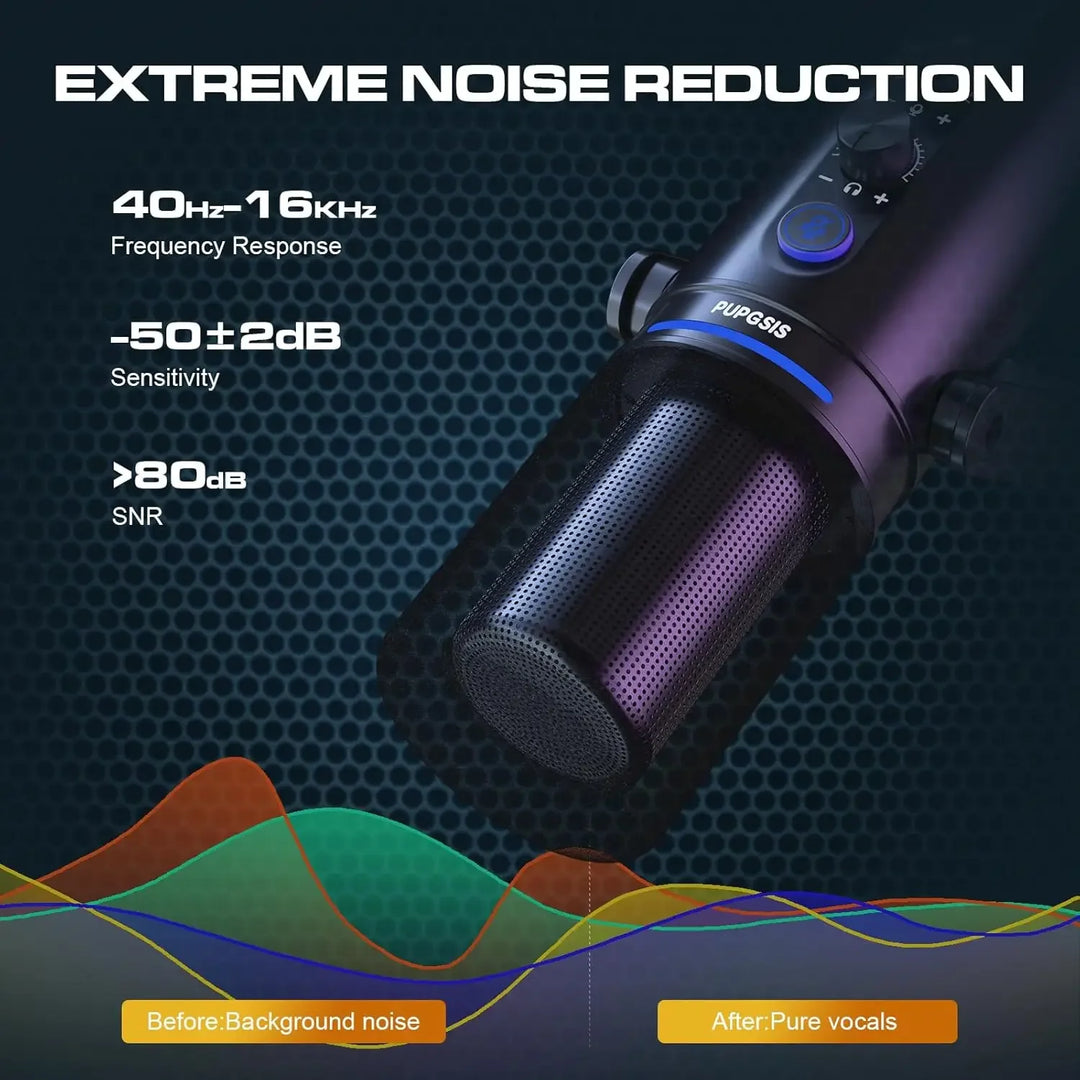 G-Mix Dynamic Podcast Microphone with USB &amp; XLR Professional Mic for Recording, Streaming &amp; Gaming