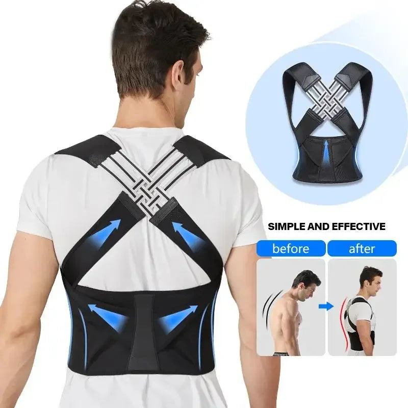 G Active Adjustable Posture Corrector Belt Back Support, Waist Trainer &amp; Spine Alignment Brace for Men &amp; Women